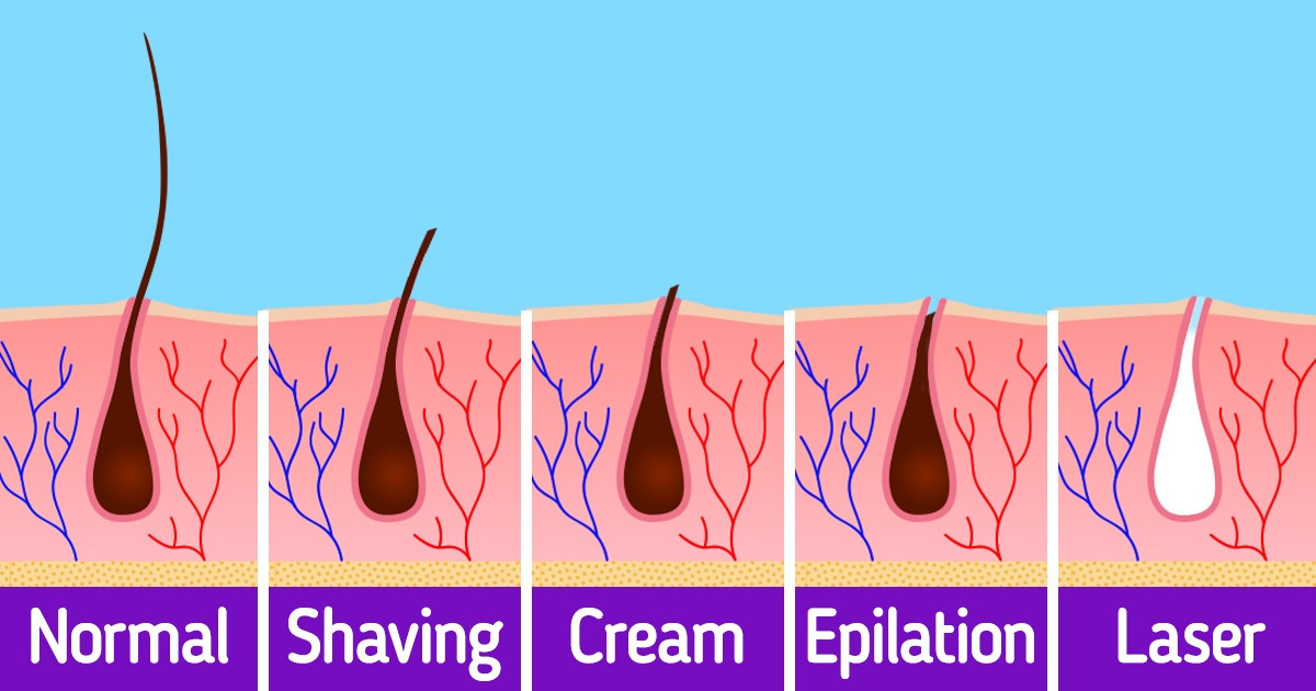 Discover the Best Hair Removal Method for You: Epilation vs Depilation