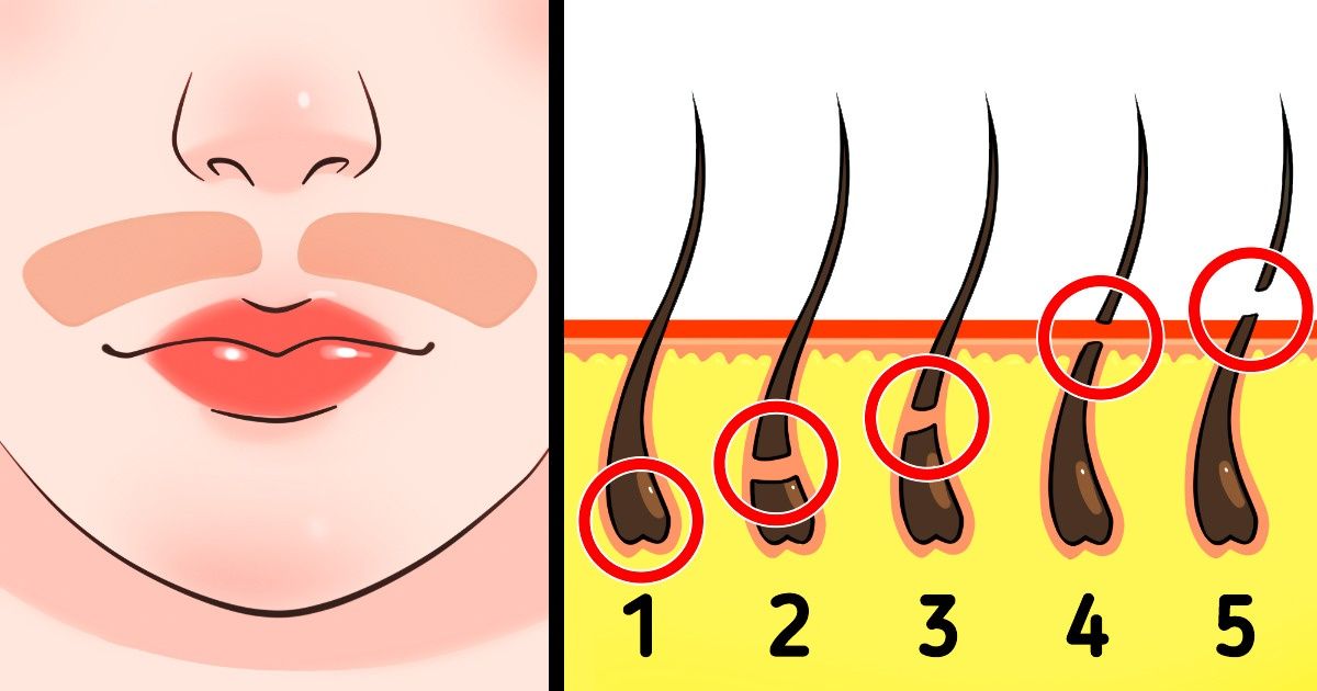 How to Remove Facial Hair