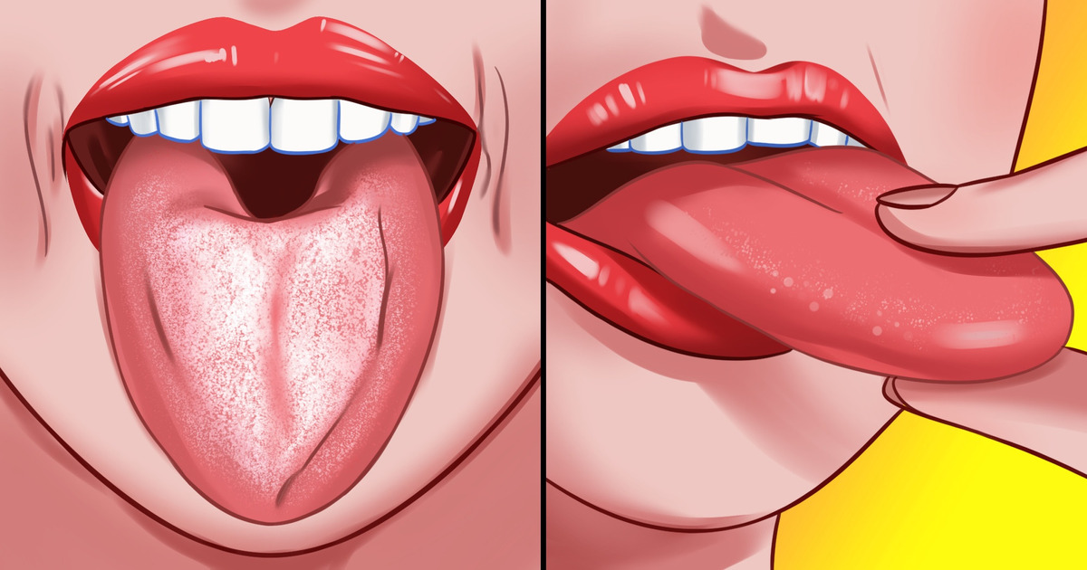 How to Clean the Back of Your Tongue