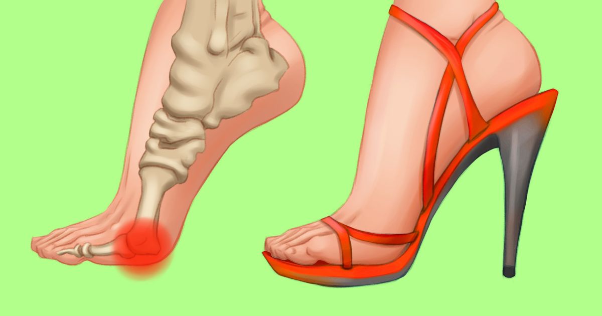 How to Wear High Heels Comfortably