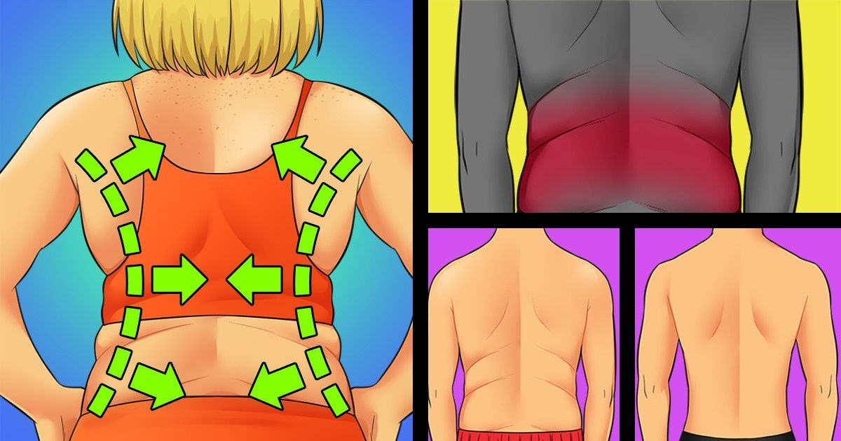 How to Get Rid of Folds on Your Back