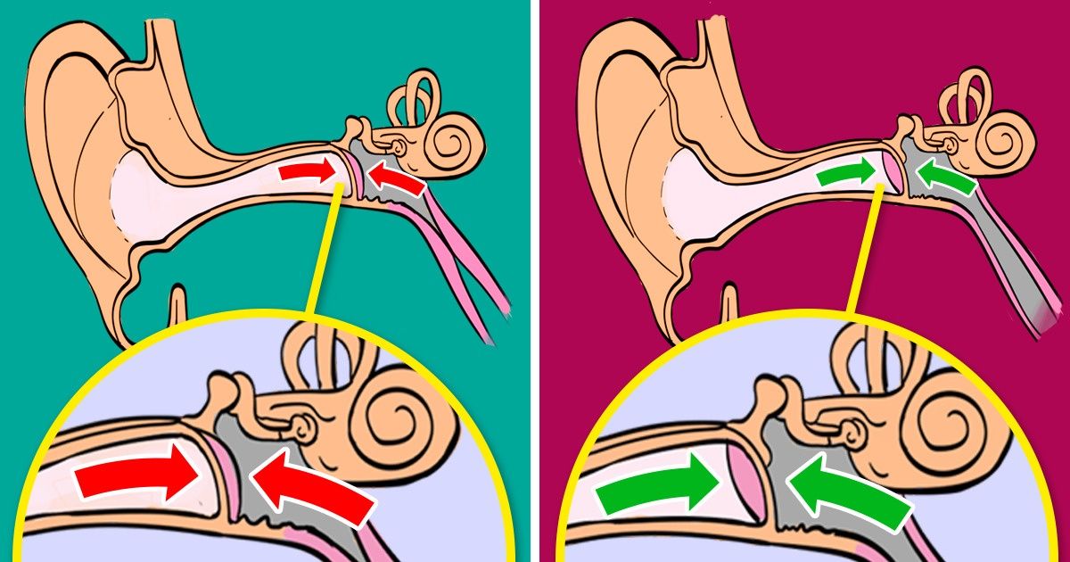 How to Avoid Ear Pain During a Flight