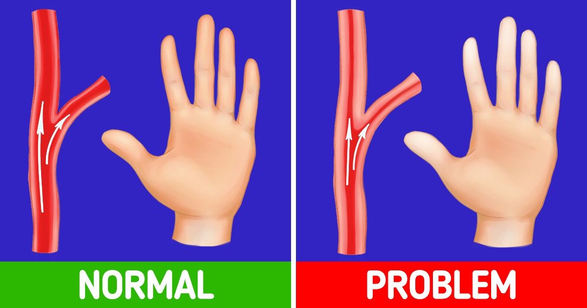 How to Warm Up Your Cold Hands