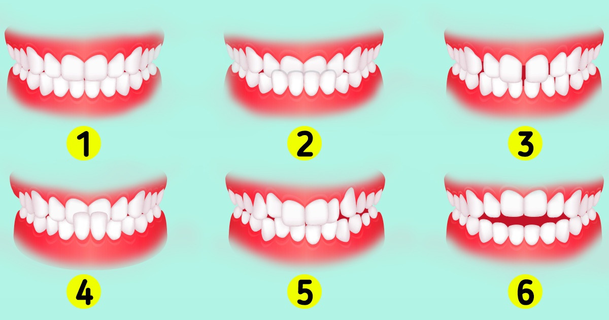 What Type of Teeth You Have / 5-Minute Crafts