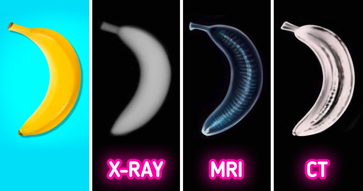 what-the-difference-between-an-x-ray-mri-and-ct-scan-is-5-minute-crafts