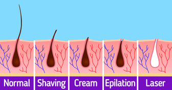 Waxing laser or shaving  which hair removal method is best  Pure blog