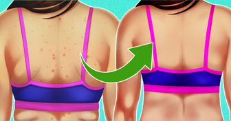 How to Make Your Back Beautiful: 6 Ways