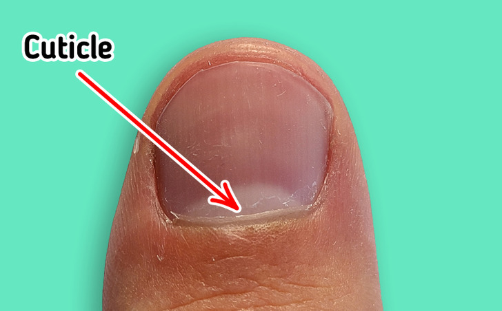 What Causes Dry Skin Around the Nails, and How to Prevent It