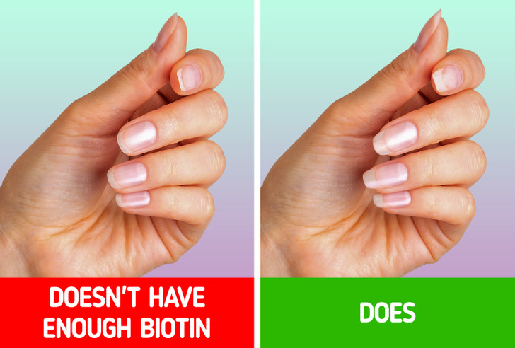4 Effective Ways To Grow Your Nails Faster