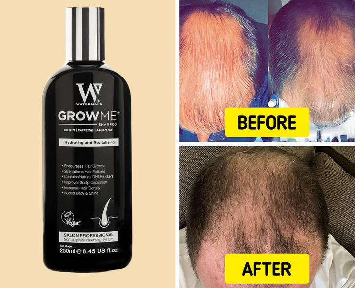 How to Prevent Hair Loss: 10 Products from Amazon That Customers Swear By