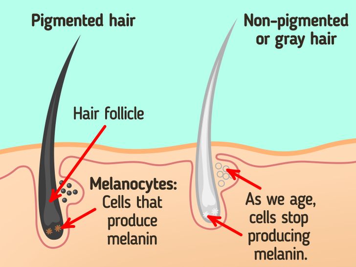 Why Young People Get Gray Hair and How to Prevent It
